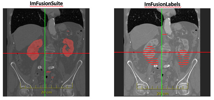 ImFusion Labels